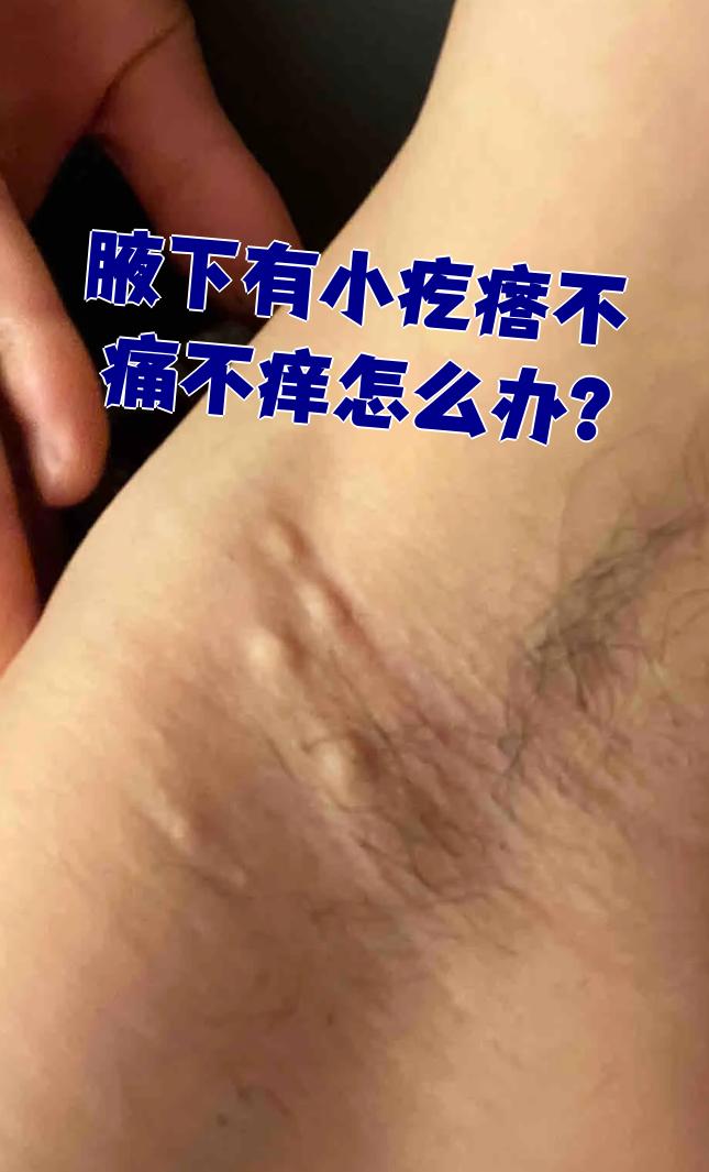 这种情况往往和腋窝清洁不够,免疫力差或者长期用免疫抑制剂有关.细