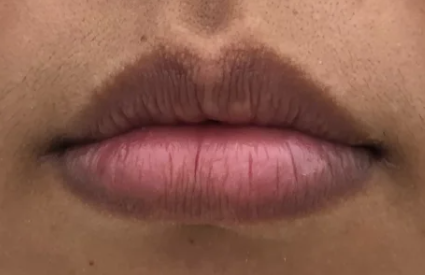 每个人的皮肤和粘膜颜色本来就有差异,所以唇色深浅不同是正常的