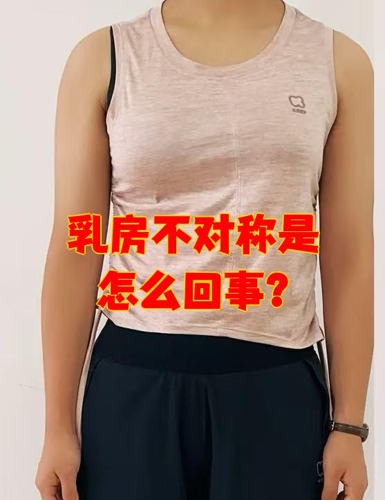 乳房不对称很常见,多数人两边乳房本来就不完全对称