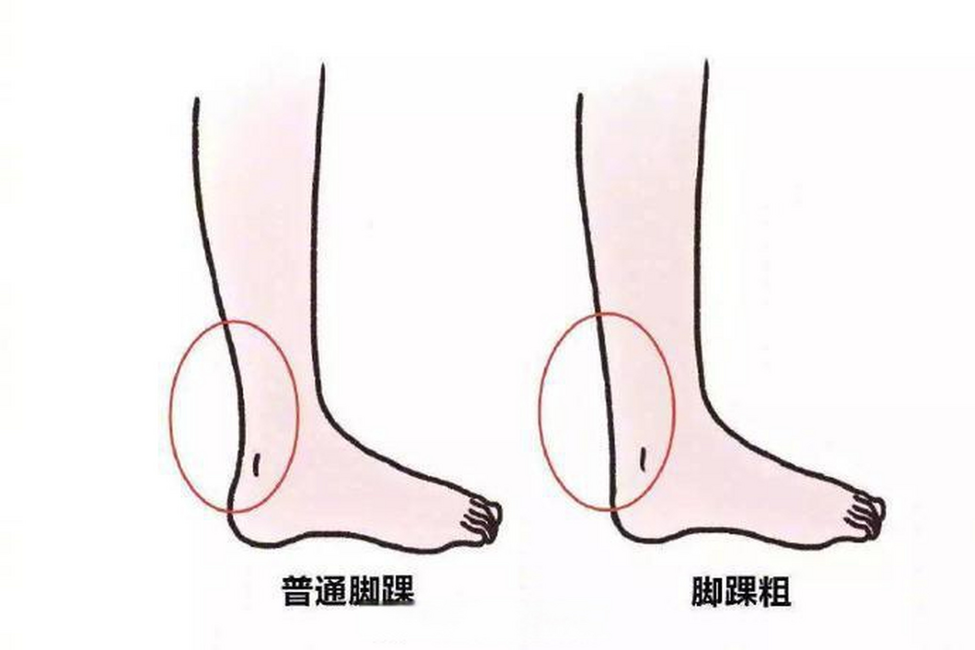 人跟腱更健康