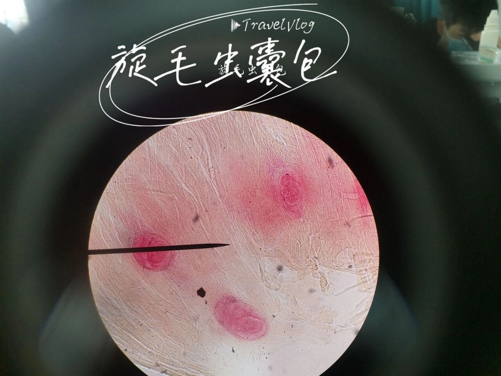 寄生虫—班氏,马来微丝蚴,广州管圆线虫 今天观察了 7015班氏丝状