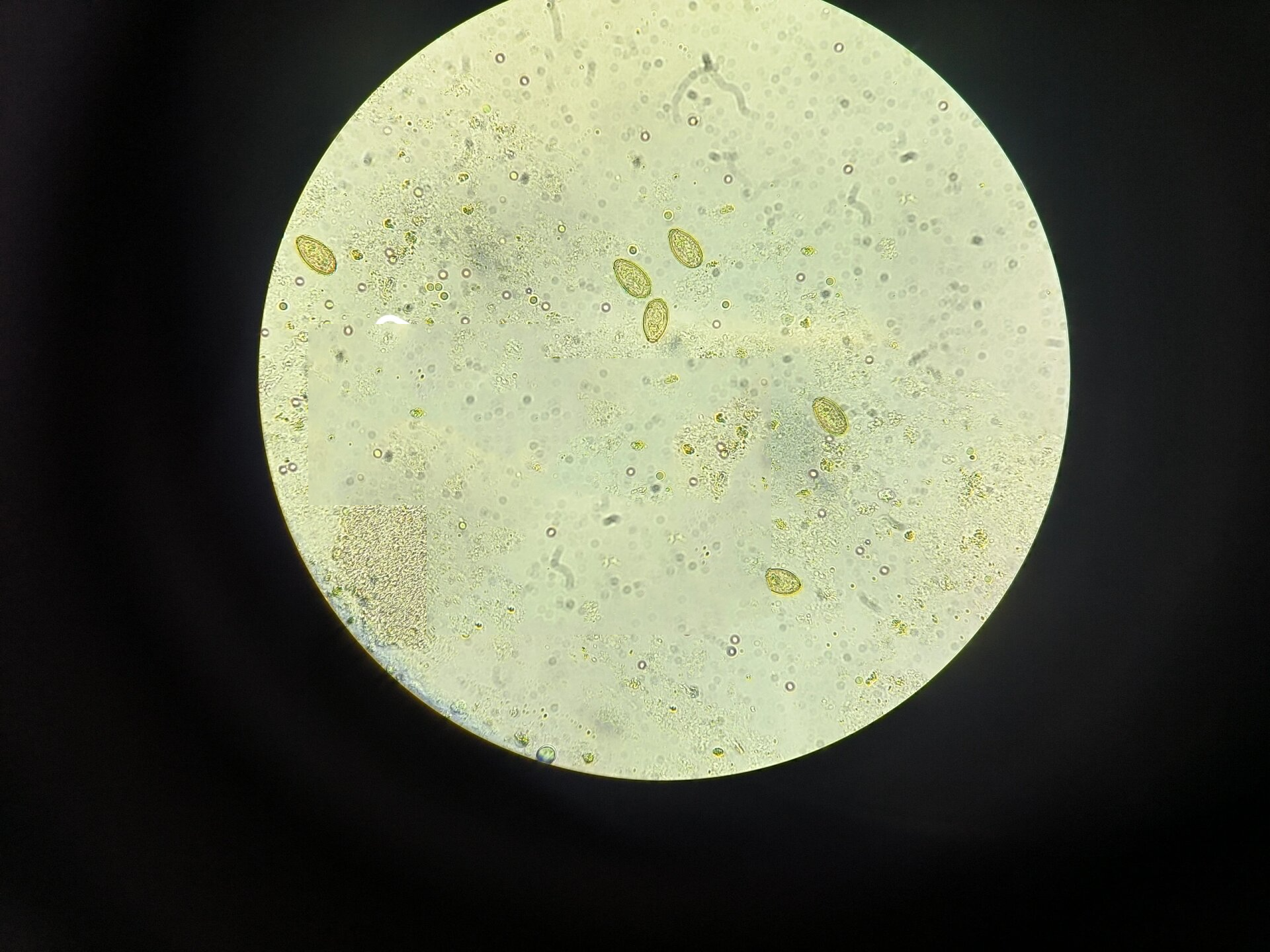 华支睾吸虫 样本:胆囊穿刺 华枝睾吸虫感染人,犬,猫,猪及其他一些野生