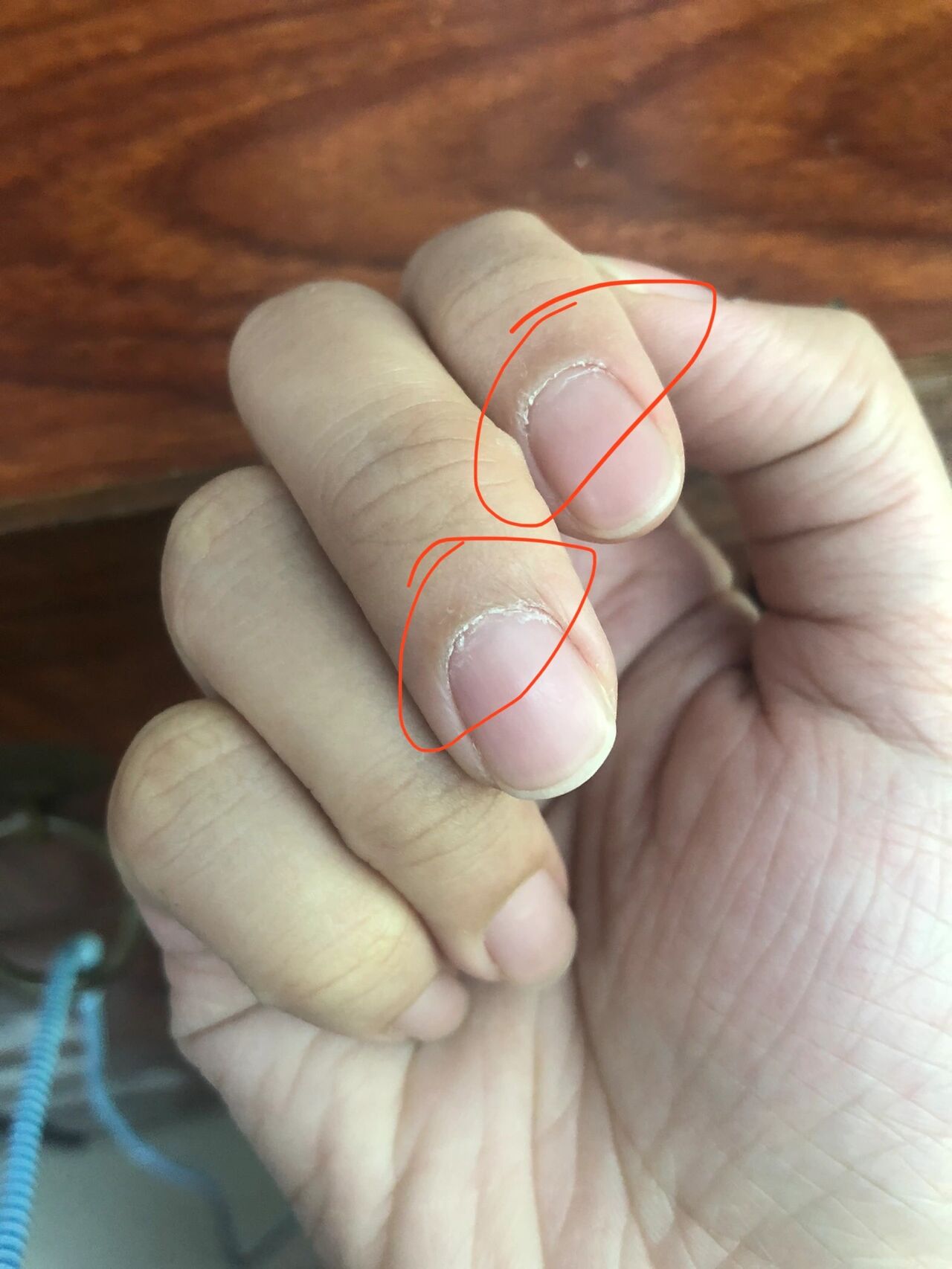 你们有没有这样的啊 到底怎么了 一直都不好