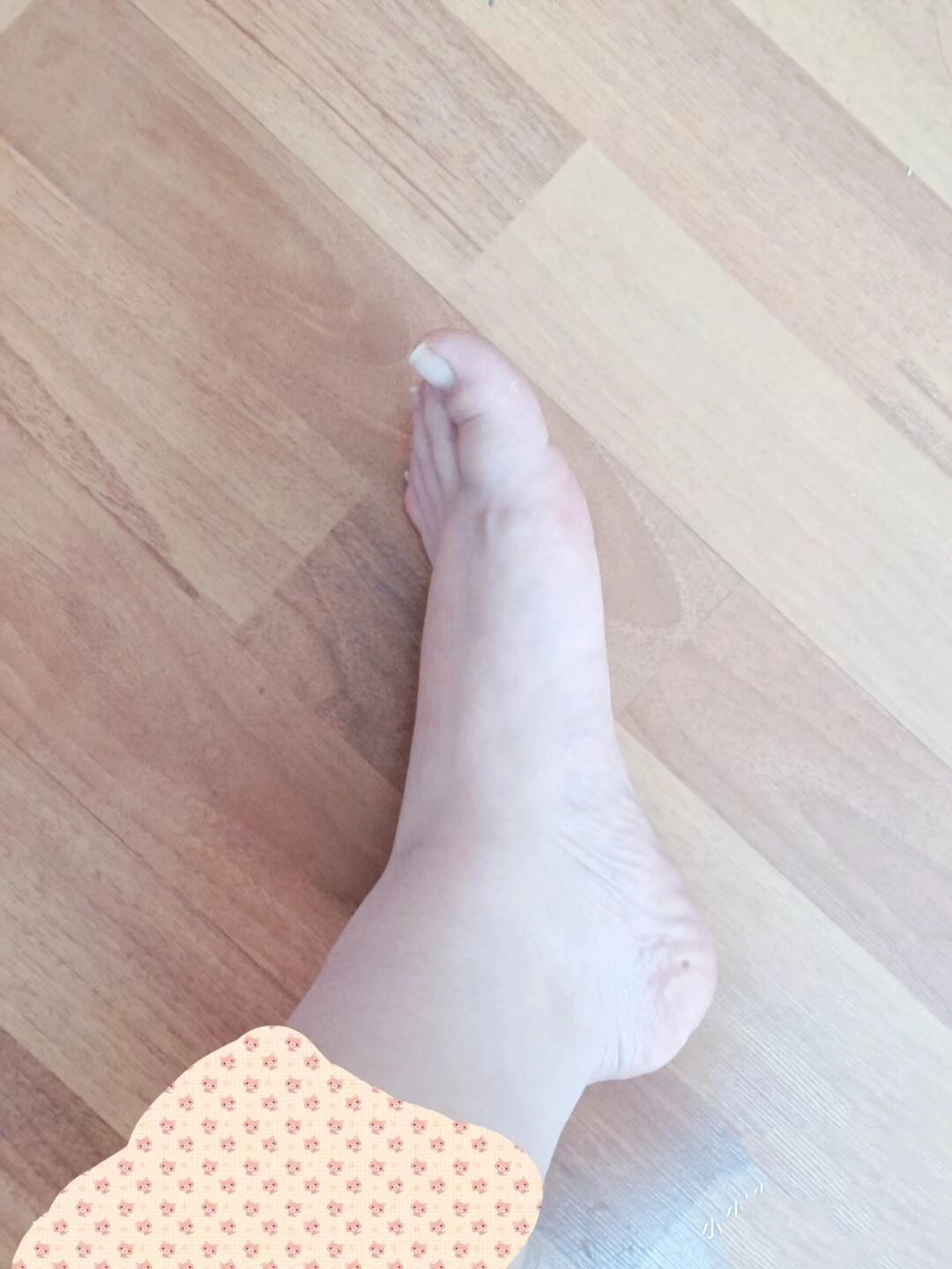 脚趾上翘这种脚型买什么样的鞋合适啊
