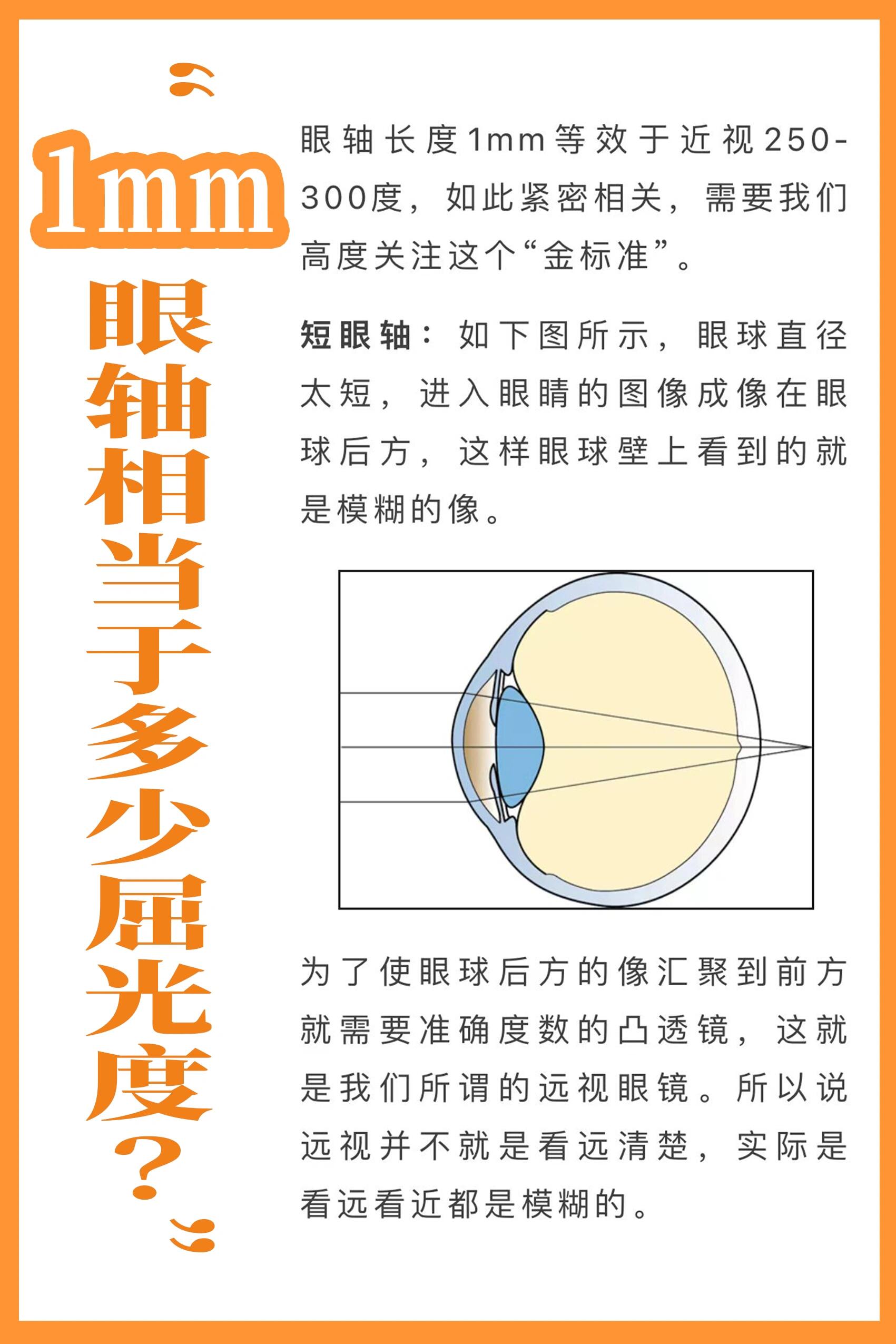 今天我们来聊聊一个超有趣的话题——眼轴是什么?