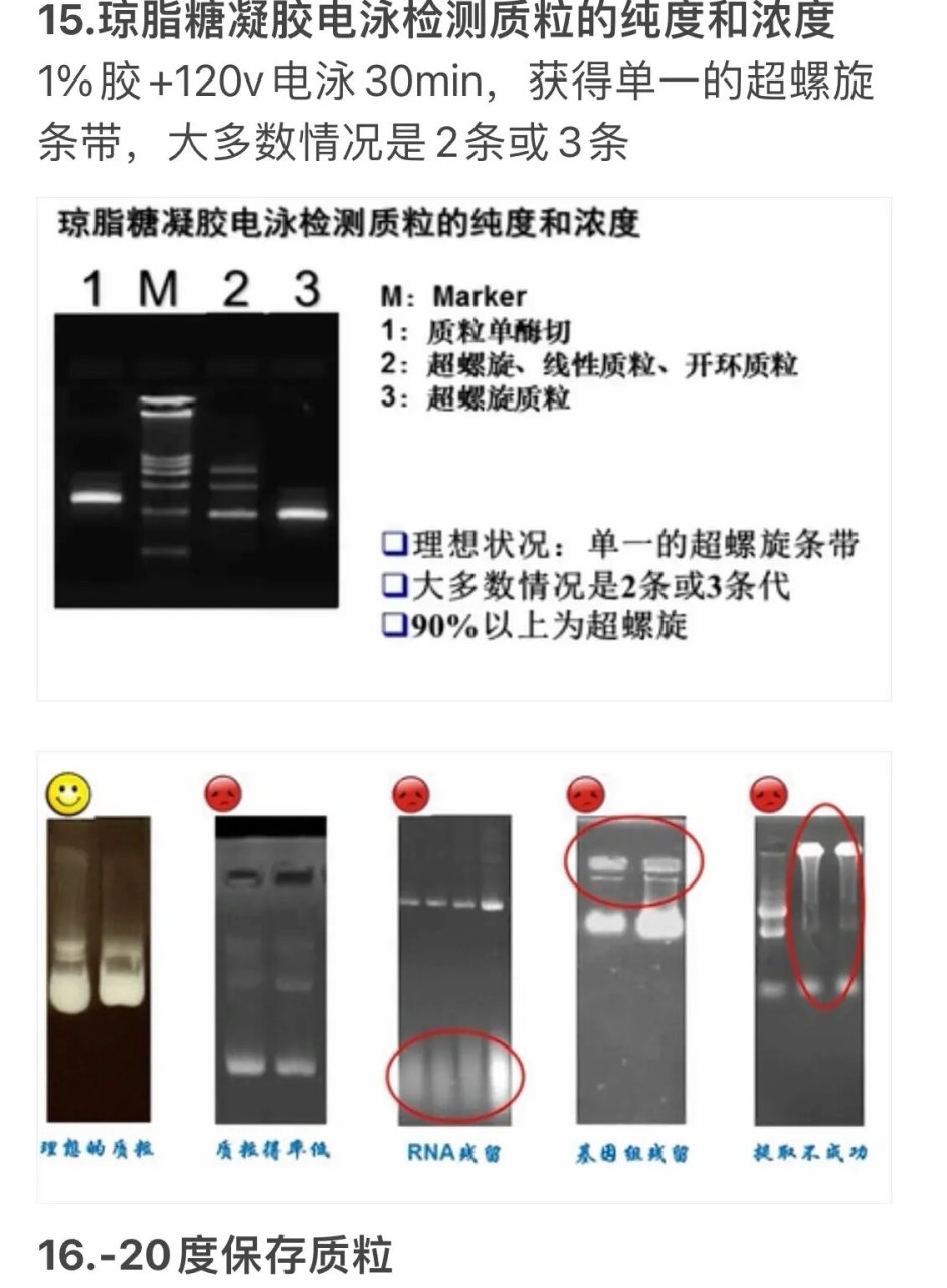 rna降解电泳图图片