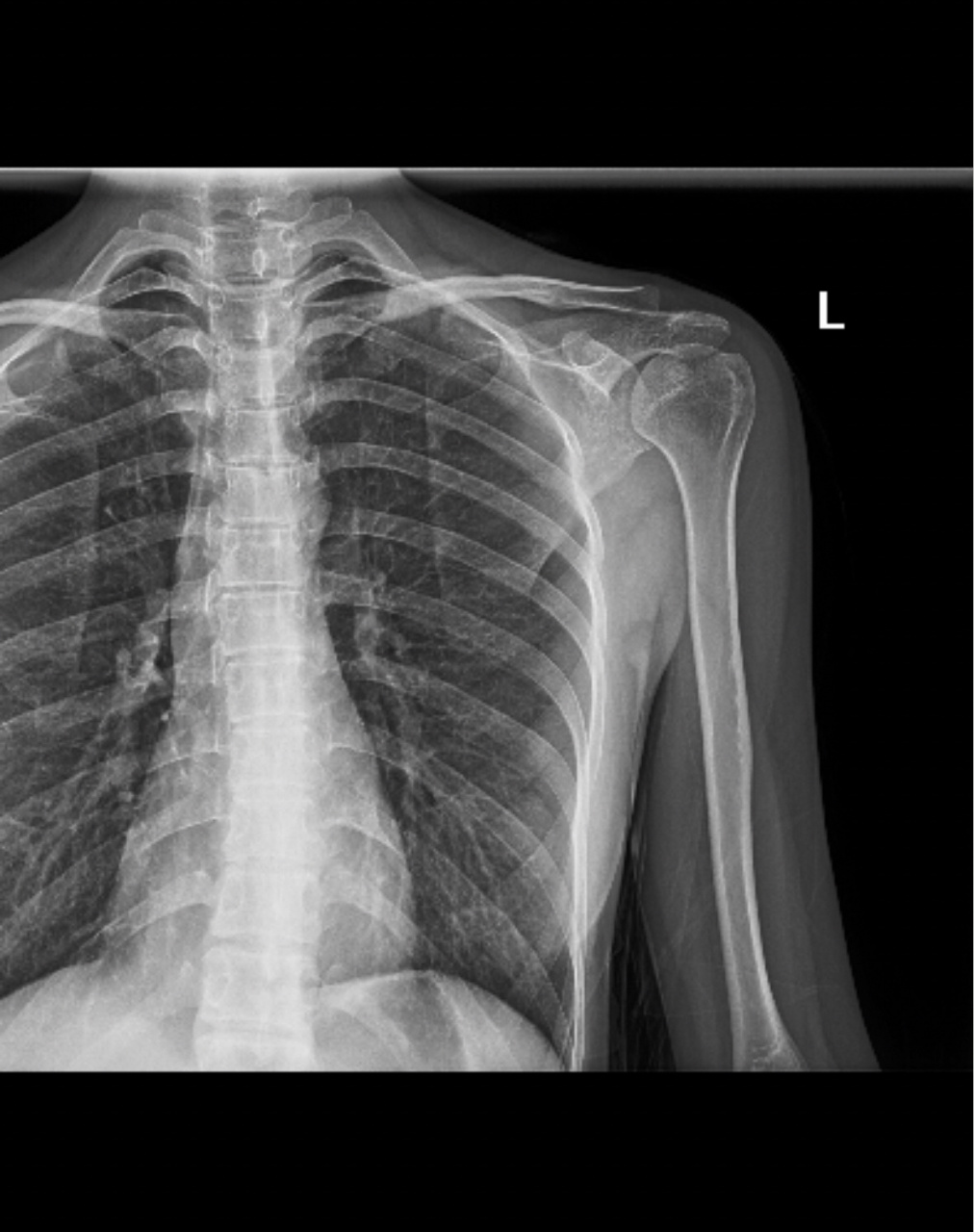 大夫开了x光片,取片后,拿给急诊另一名医生查看结