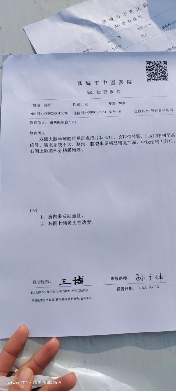 脑供血不足,颈椎病 因为持续性的头沉,医生让我检查了颅脑核磁共振