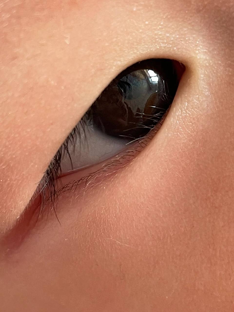 下眼睫毛前半部分总是贴眼球上,导致她经常揉眼睛98,有没有同款的