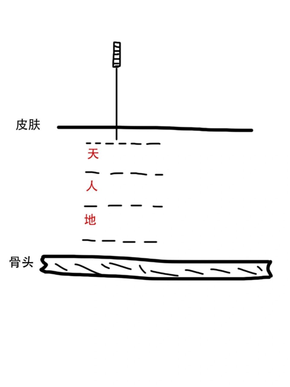 烧山火与透天凉 烧山火与透天凉