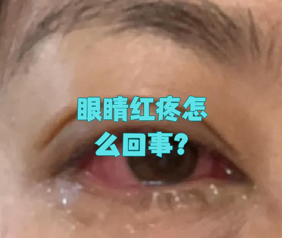 眼睛为什么红