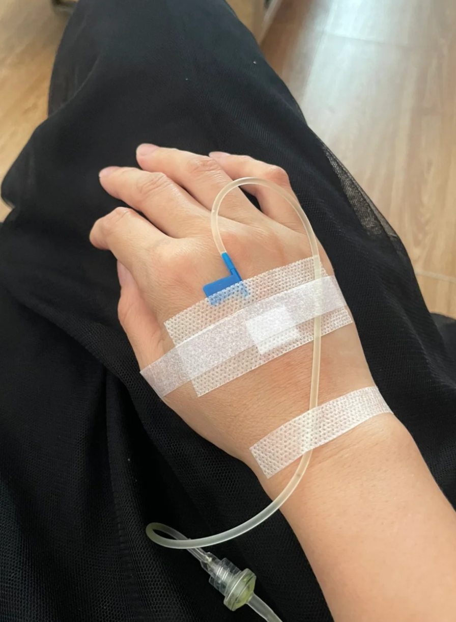 静脉输液常见五个部位