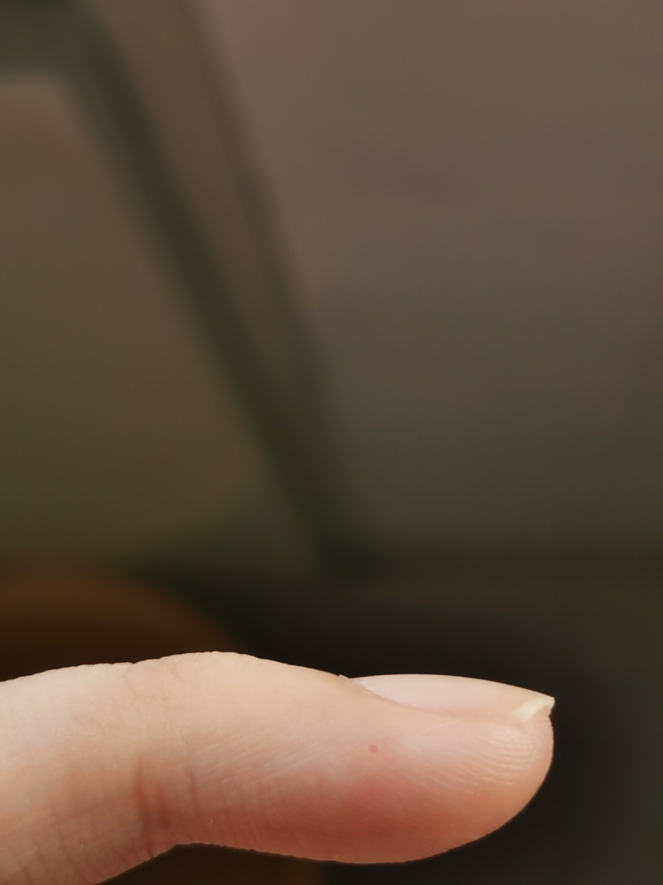 手指湿疹 手指指腹长了好多小水泡,3月16开始长的,到现在4月27了还没