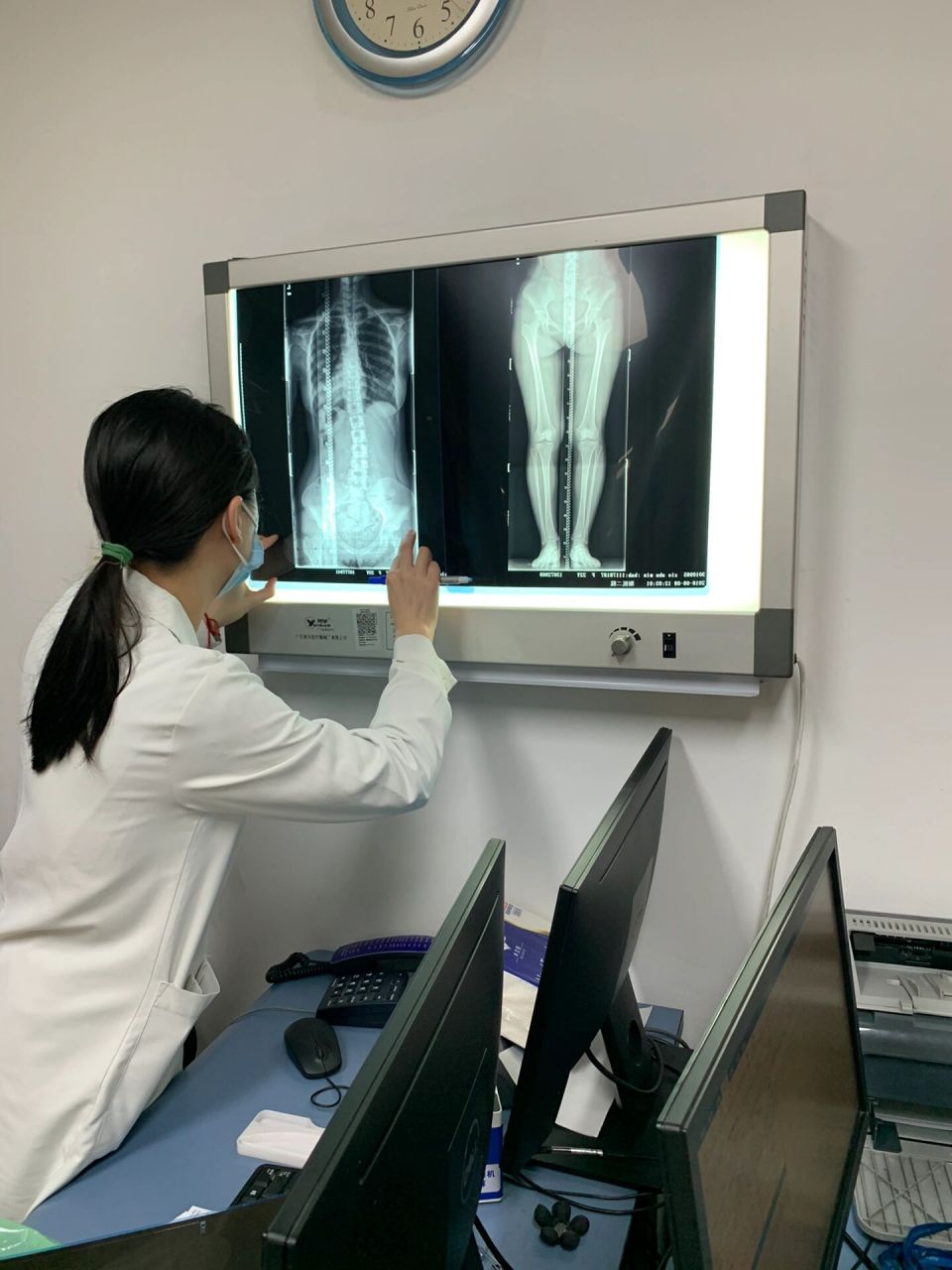 生病日记 | 浙江省中医院推拿科脊柱侧弯 挂了一个蒋忠医生的专家号