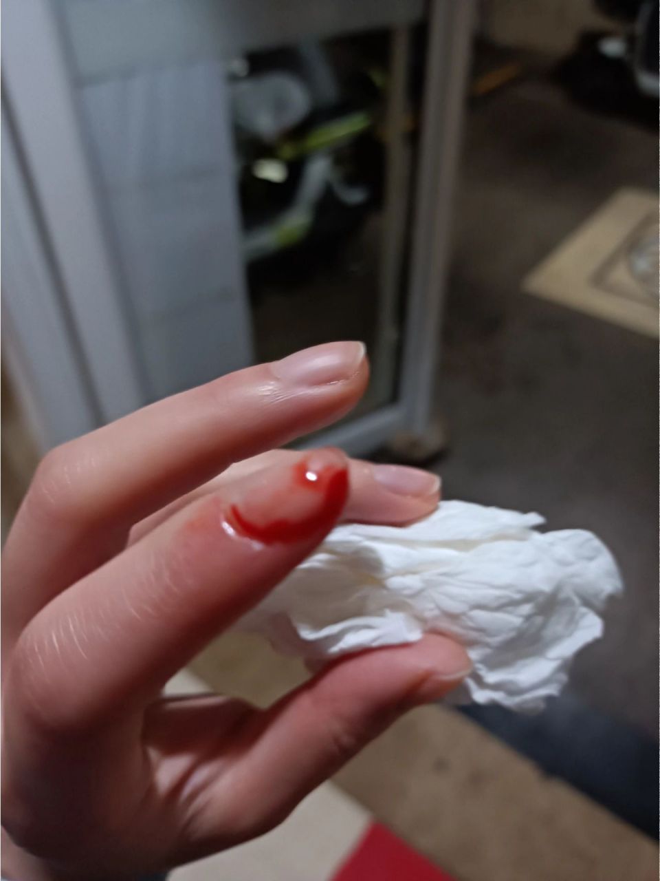 流了好多血,医生让我吃了云南白药保险子 手拿菜刀