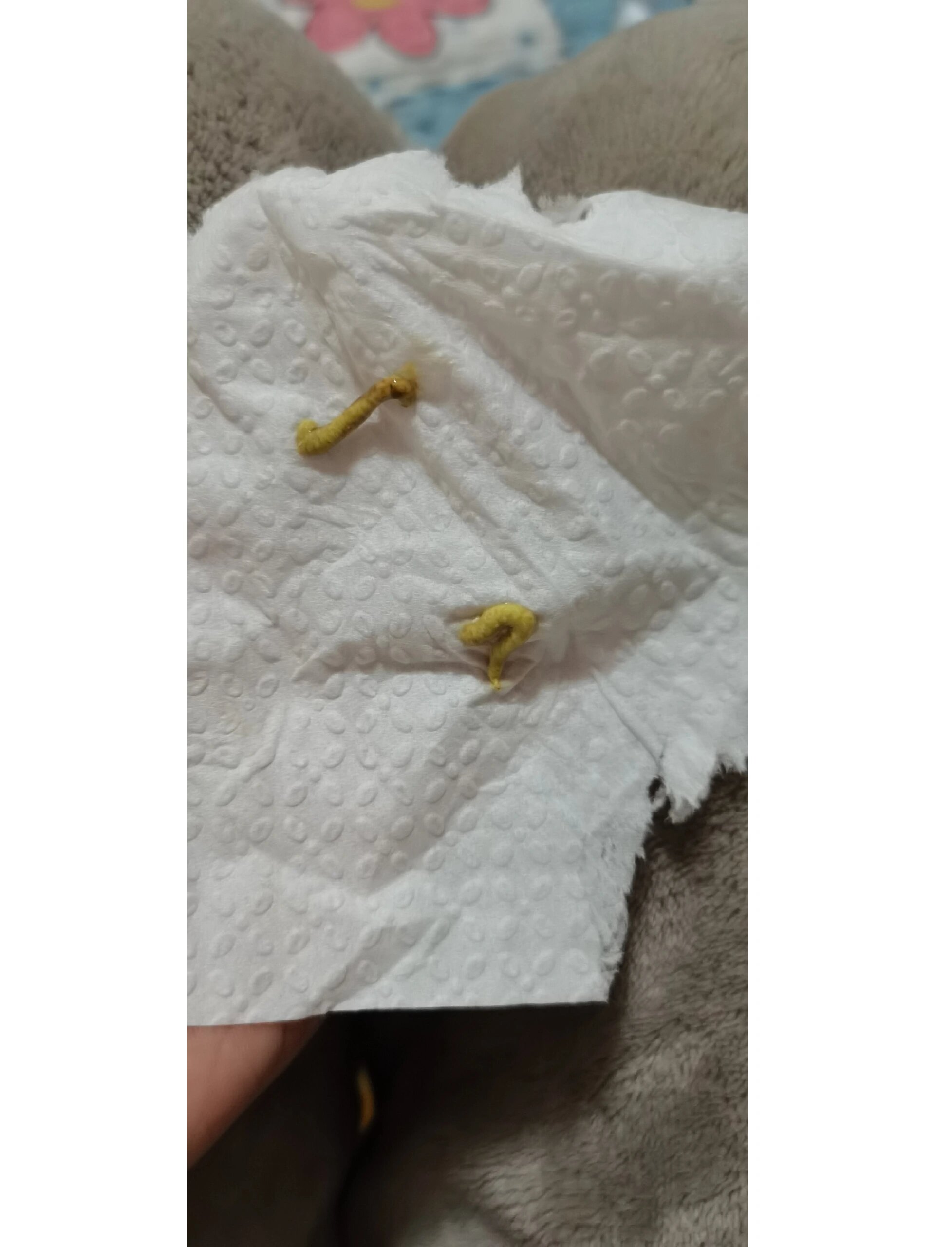 虎皮鹦鹉拉粑粑黄色 我家两个月大的虎皮鹦鹉突然拉