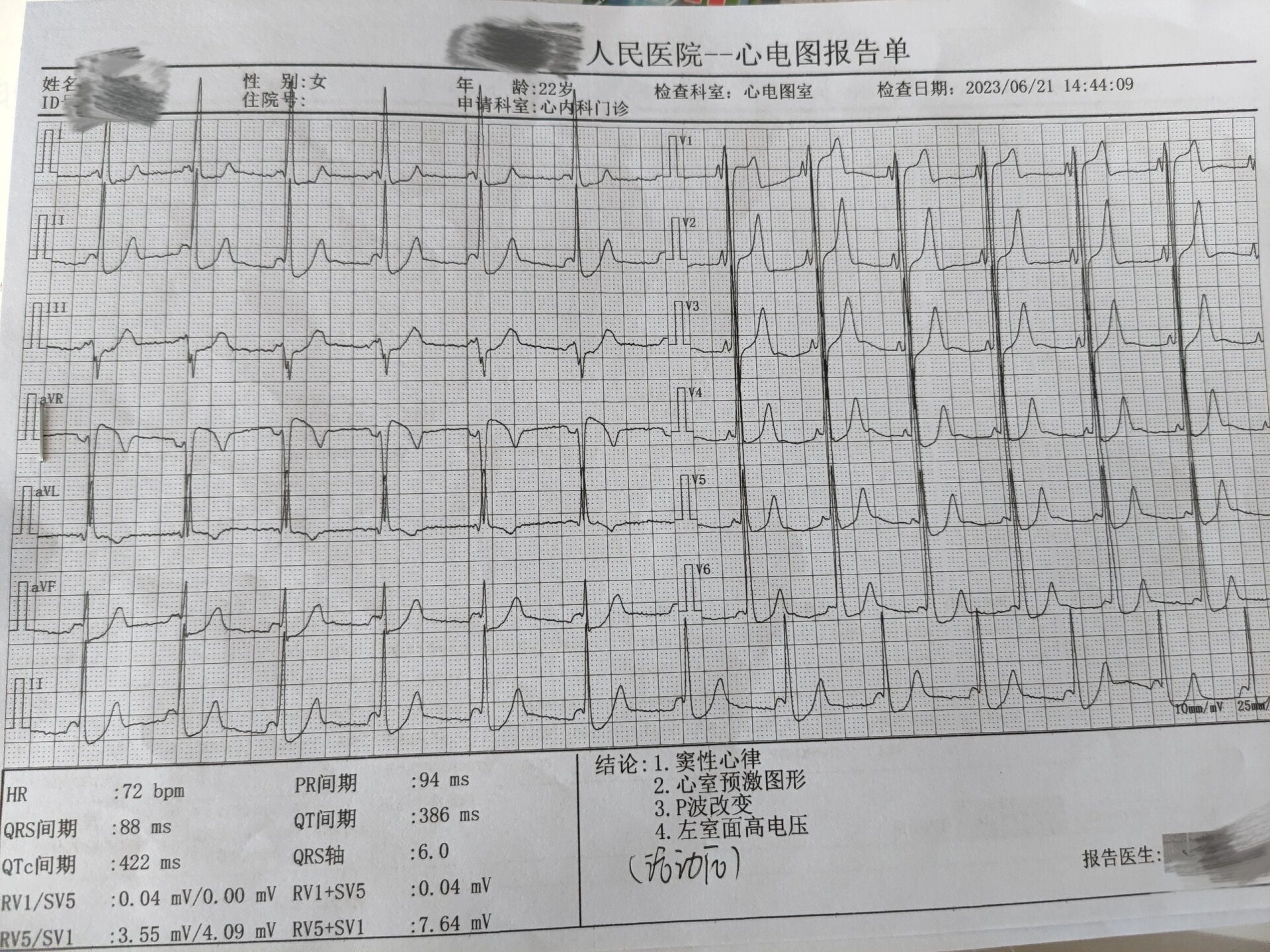 心室预激心电图图片