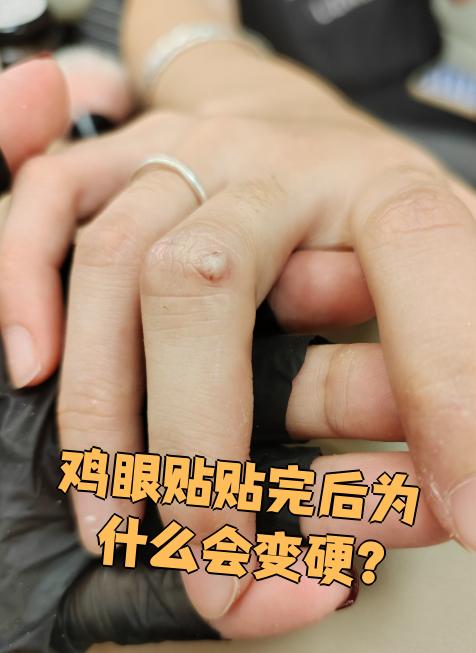 早上睾丸为什么会硬为什么在线 早上睾丸为什么会硬为什么在线