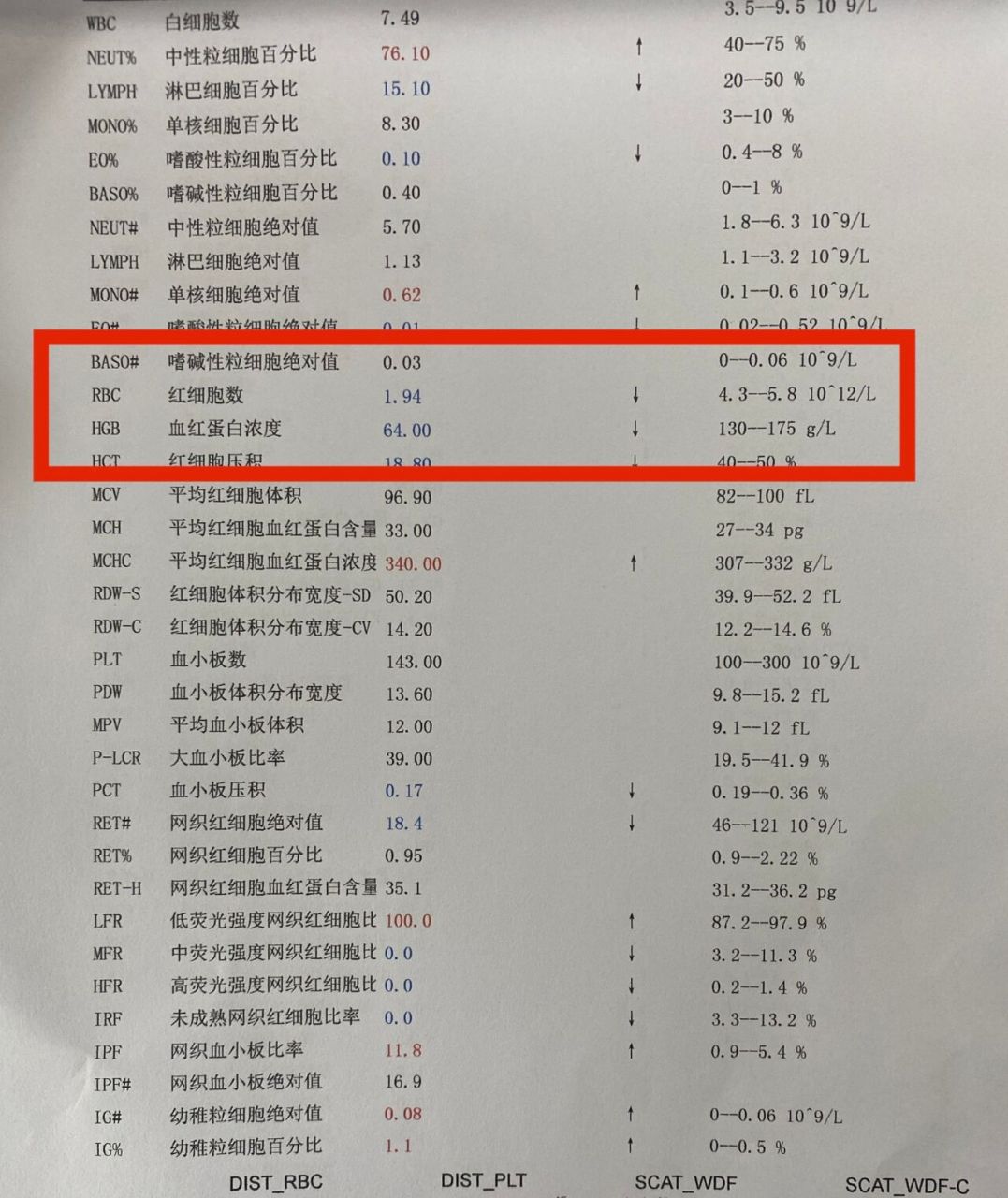 怎么判断是否贫血?主要看这两项指标!