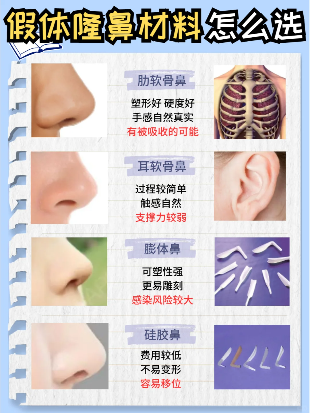 ①硅胶鼻: 老朋友了属于是,费用相对来说较低,不易变形,但容易移位