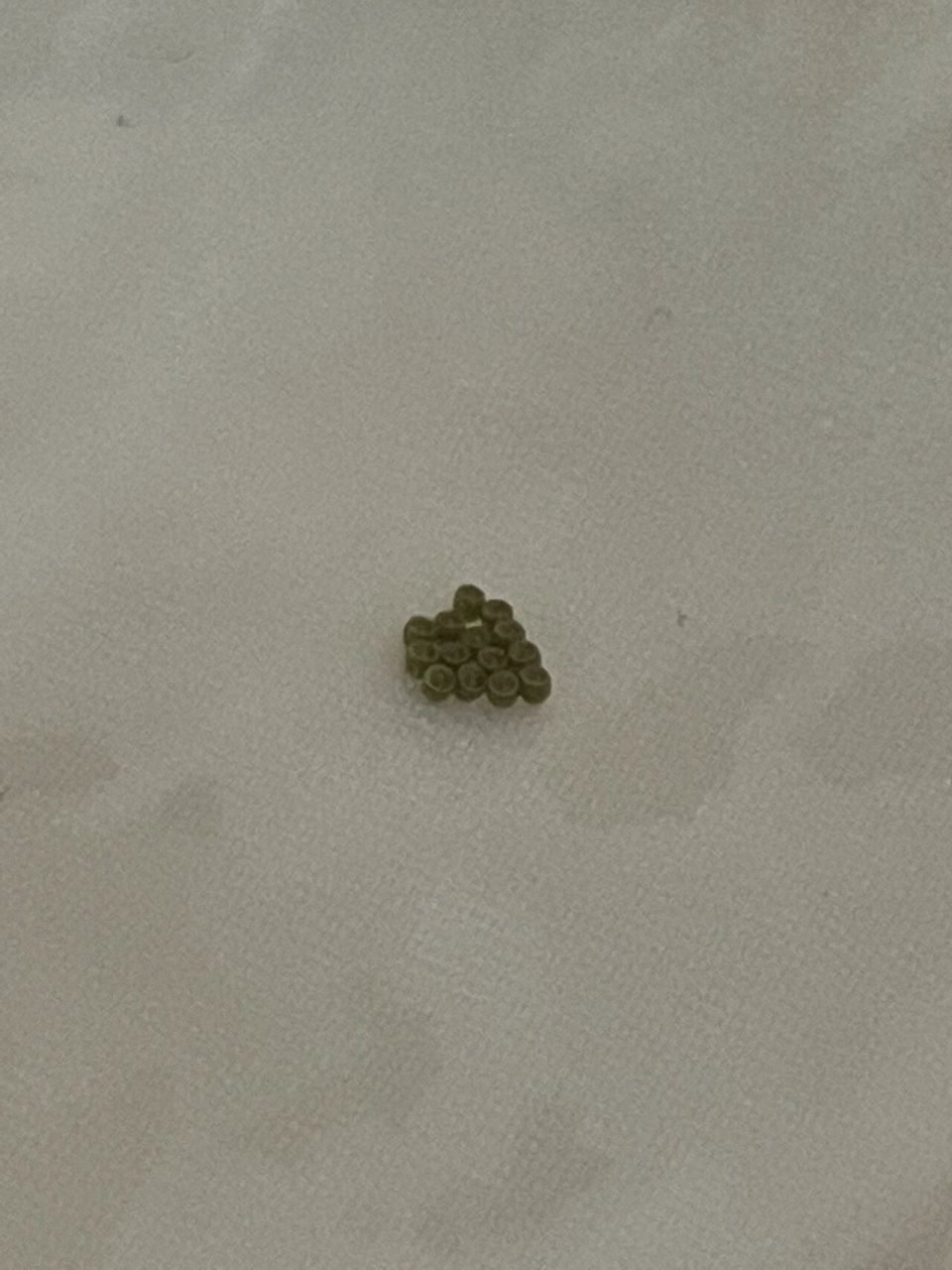 求助这种衣服上的小颗粒是虫卵吗? 是什么虫卵?有点害怕