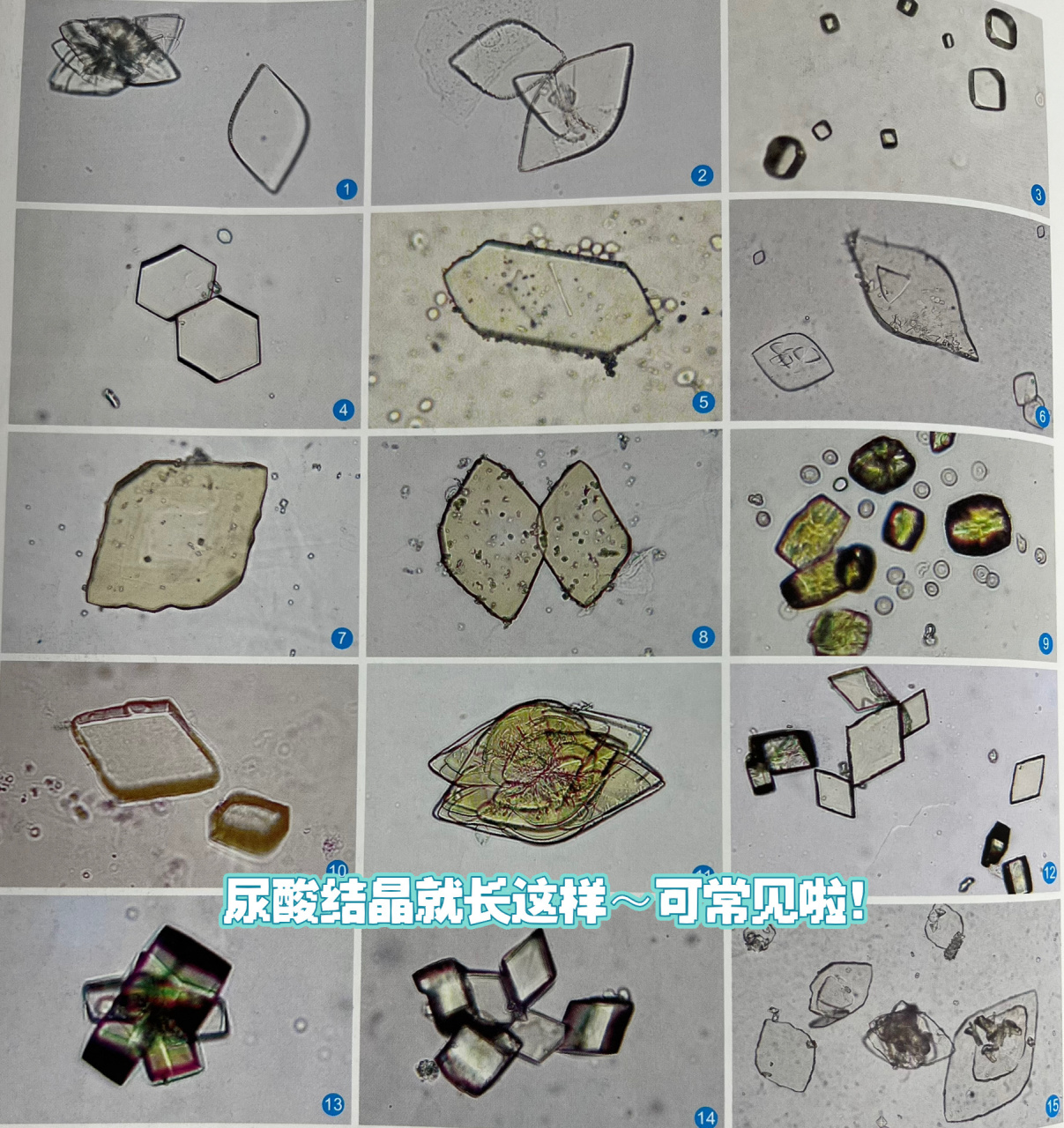 猫磷酸铵镁结晶图片图片