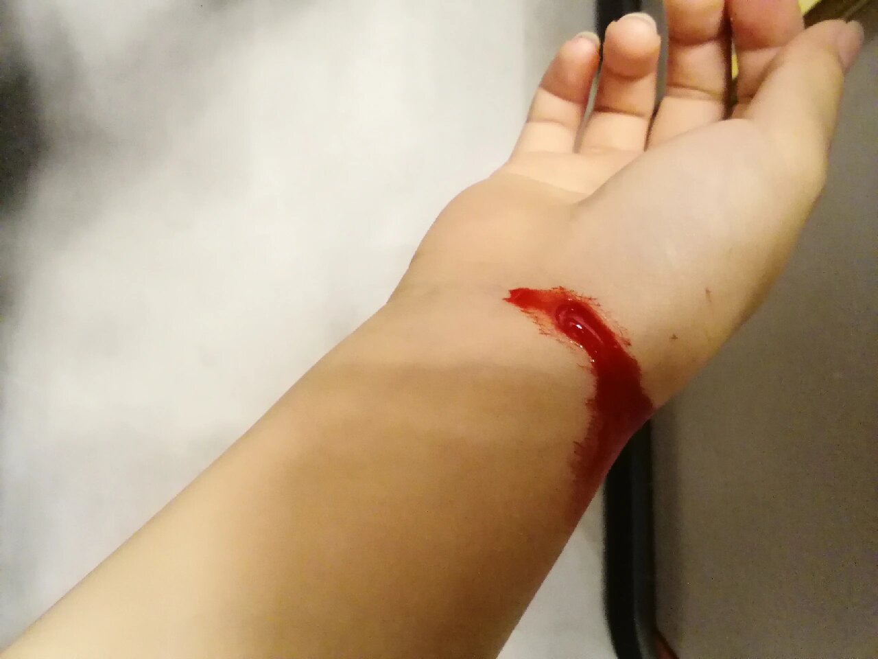 被菜刀切到手腕了快疼死了血一直流