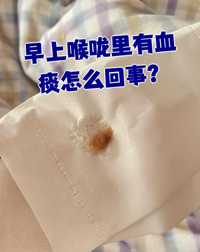如果血来自口腔,通常不会通过咳嗽带出来