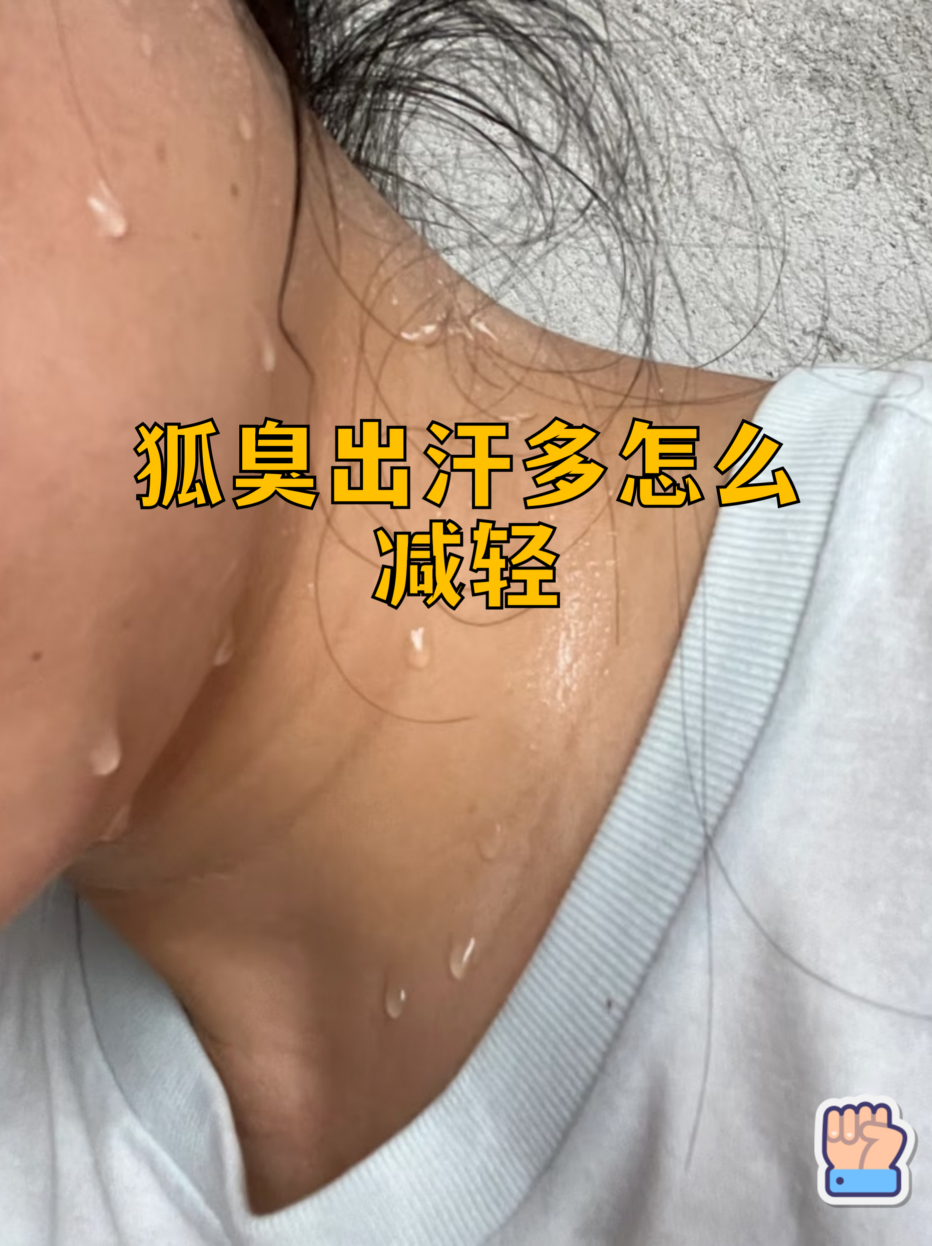 有狐臭的人腋下图片