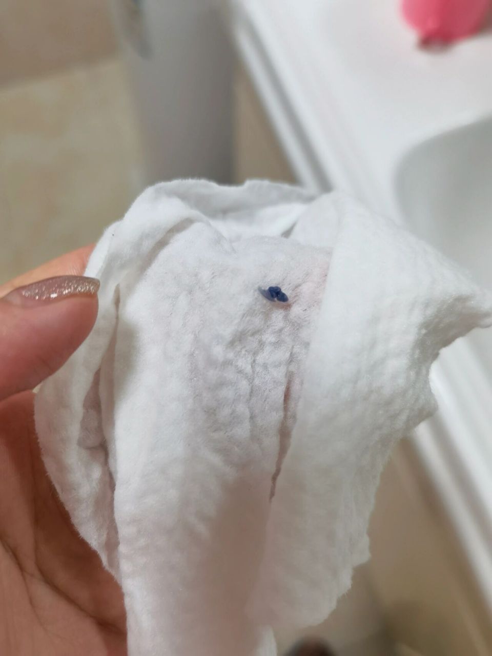 顺产侧切撕裂线不吸收 生完大概45.