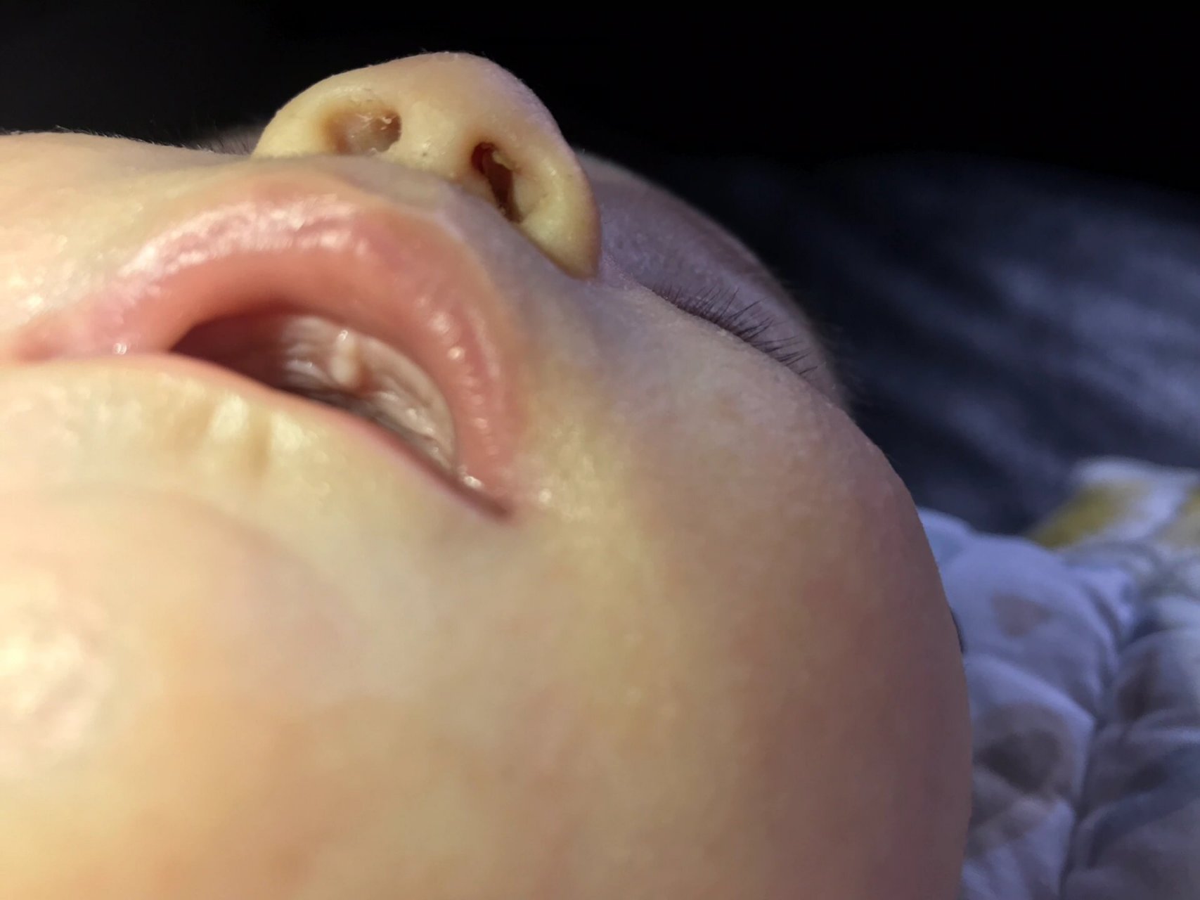 今天发现宝宝口腔上面有一块白色的凸起,有宝妈见过类似的吗?