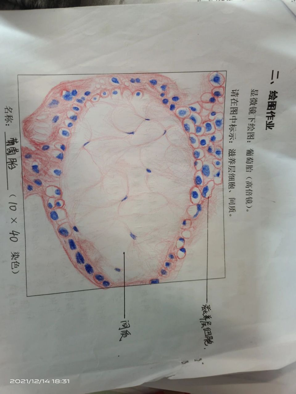 炎细胞红蓝铅笔手绘图图片