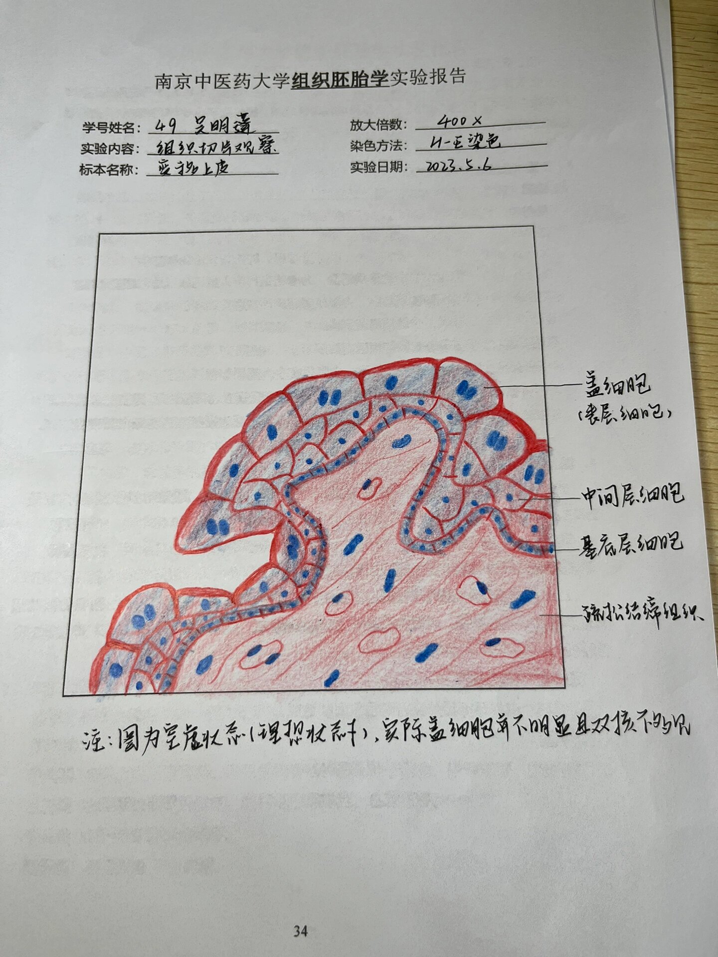 变移上皮40倍手绘图图片