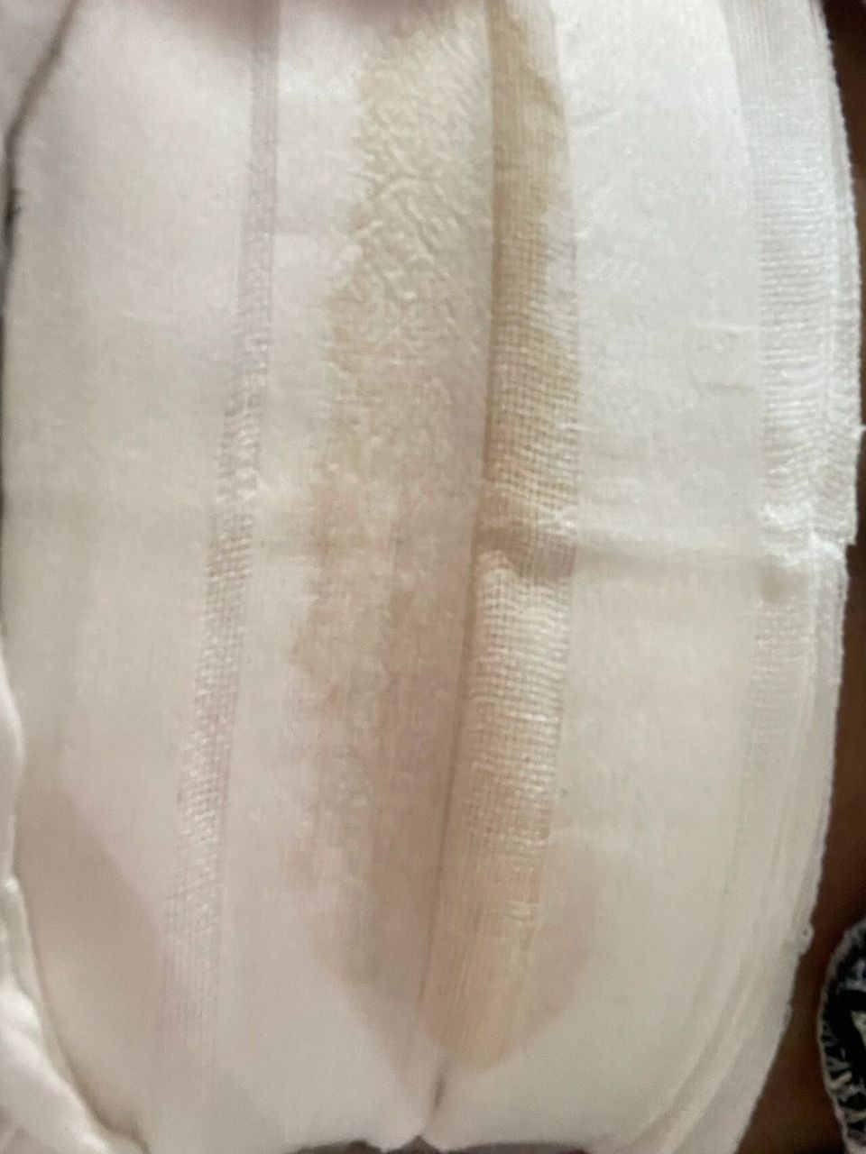 顺转剖77脂肪液化 伤口切开的第四天,清创的第四天,每天生不如死.