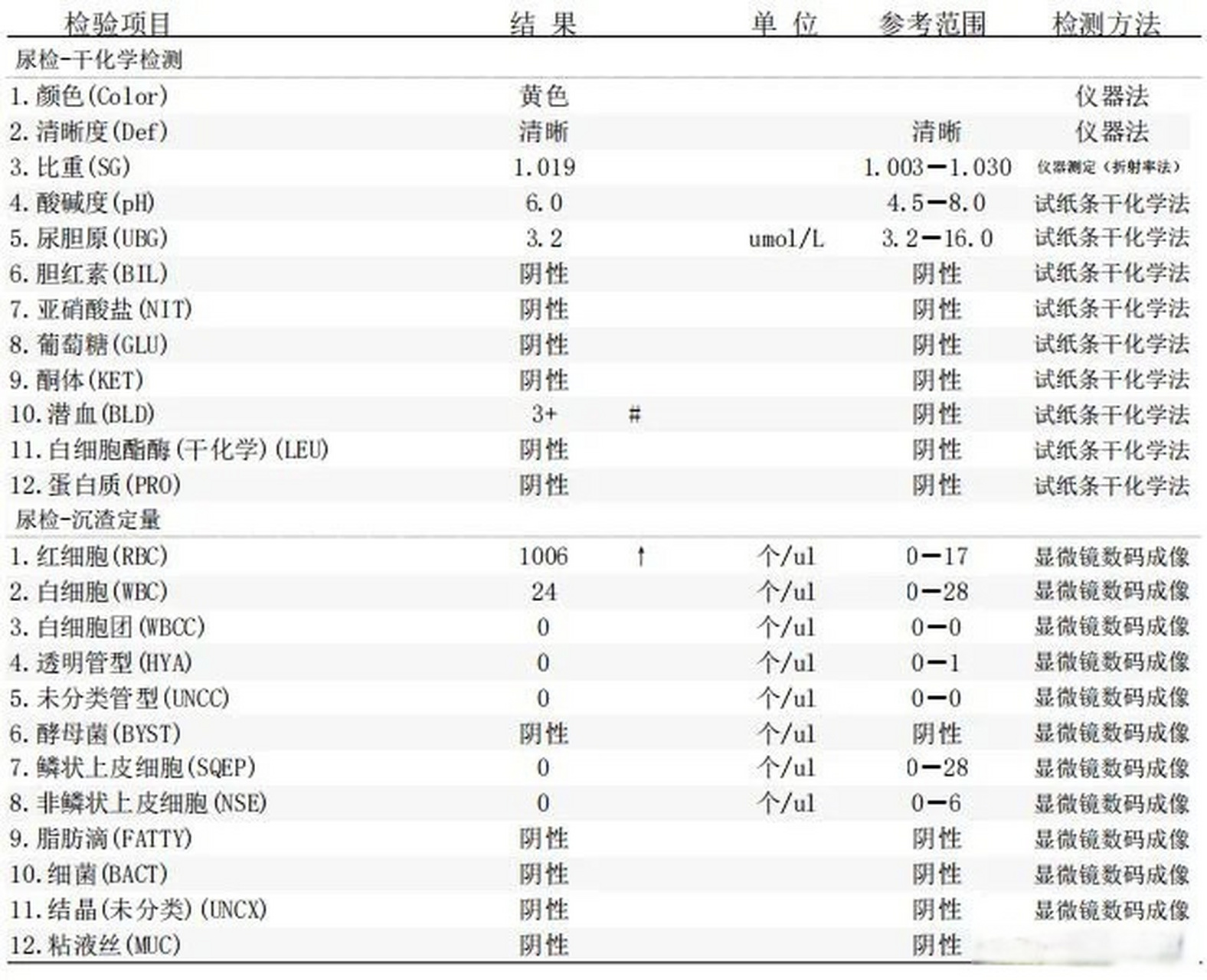 尿沉渣红细胞计数图片