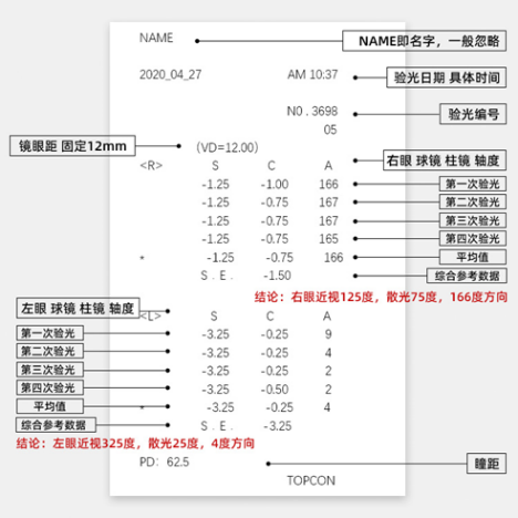 眼睛有散光隐形眼镜度数要怎么换算