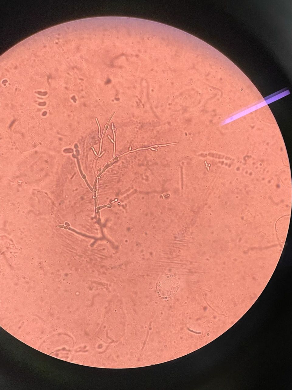 毛霉菌显微镜下图片图片