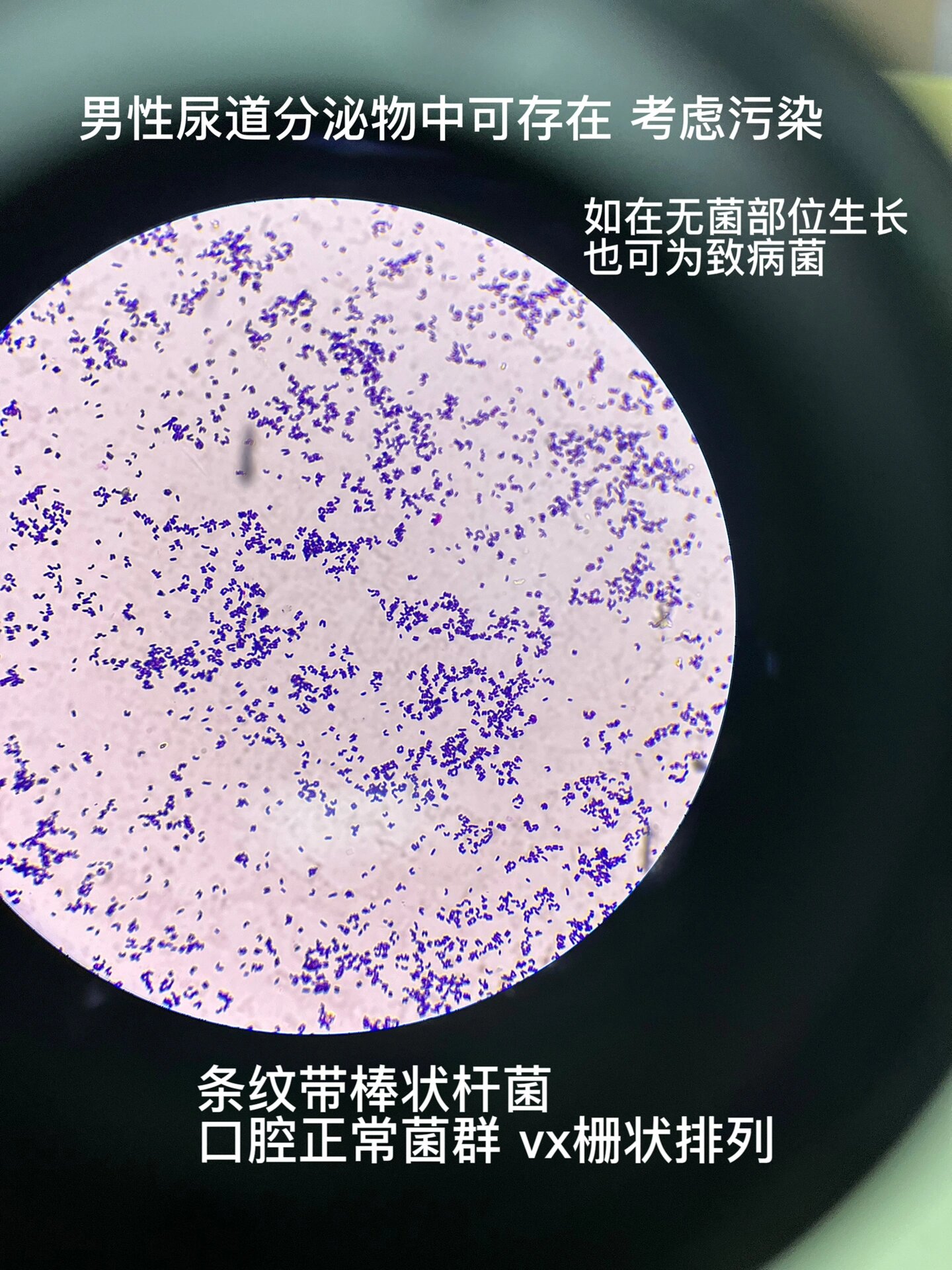 每日一种菌 条状带棒状杆菌