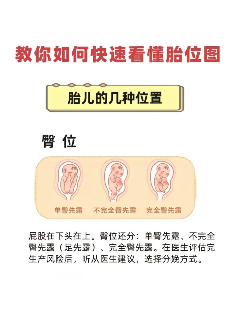 新手爸妈必看!如何看懂不同的胎位