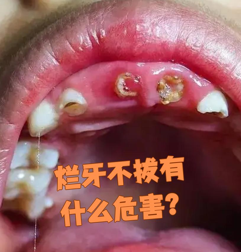 为什么牙臭