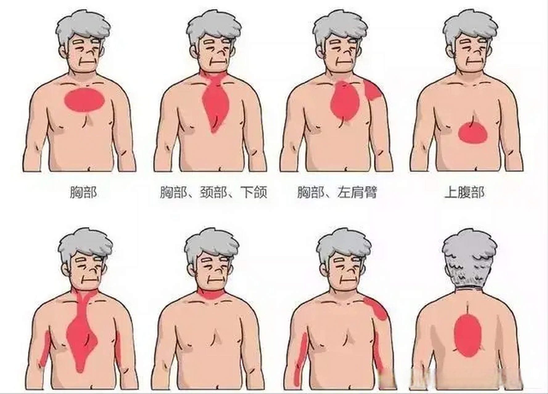 心梗位置判断 图图片