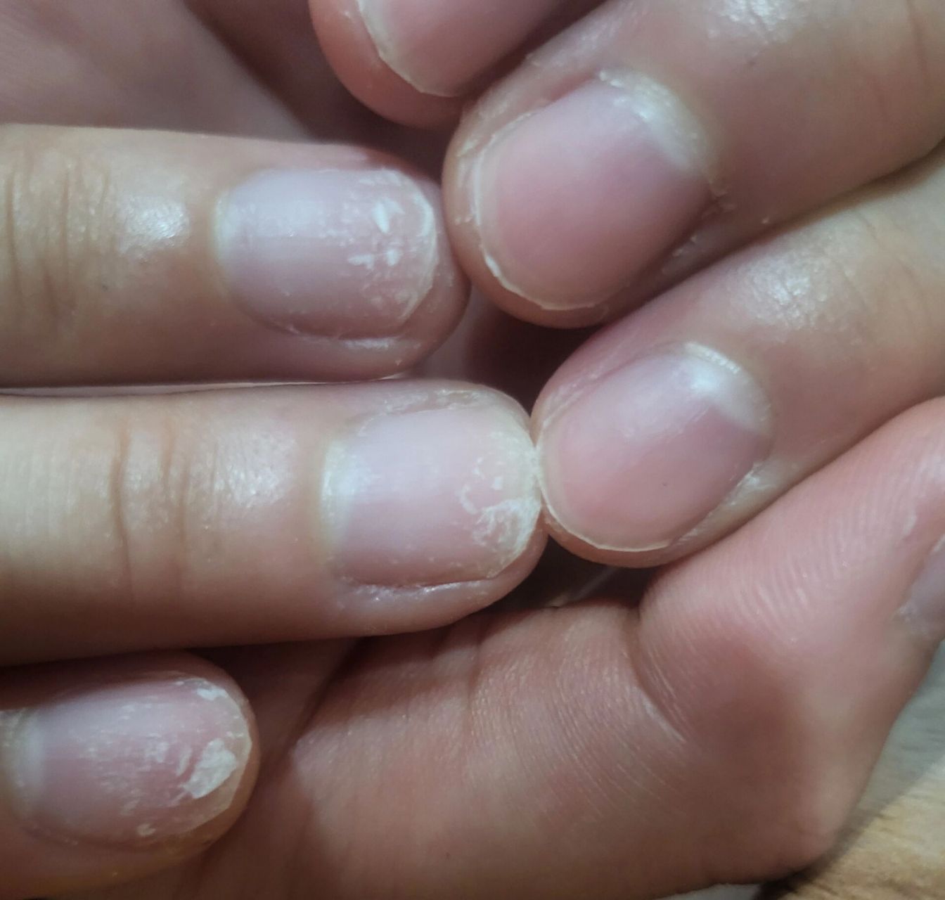 美甲卸下来,指甲发白是怎么回事啊