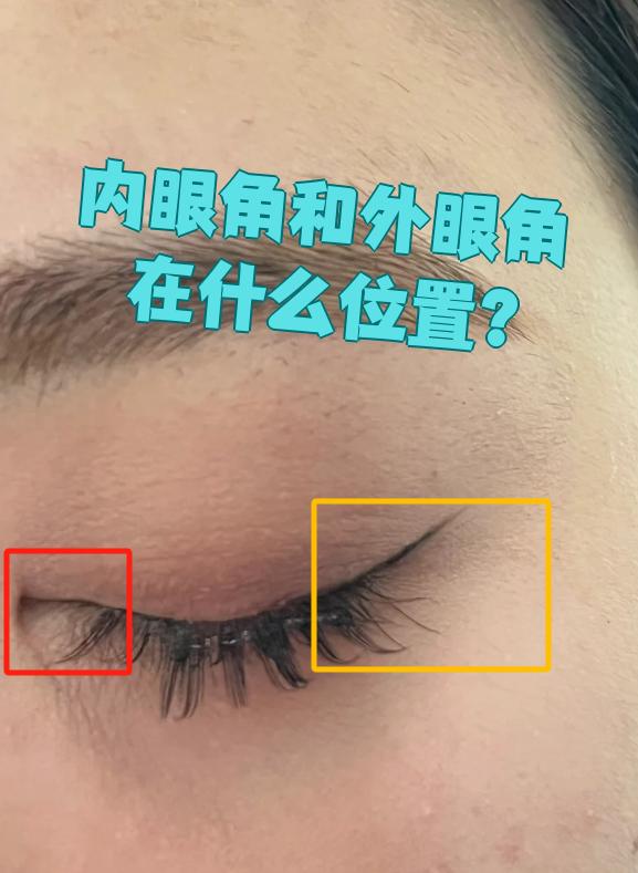 眼睛的内眼角和外眼角在医学上叫内眦和外眦