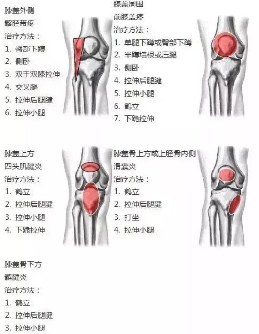 膝盖后面的窝疼怎么办图片