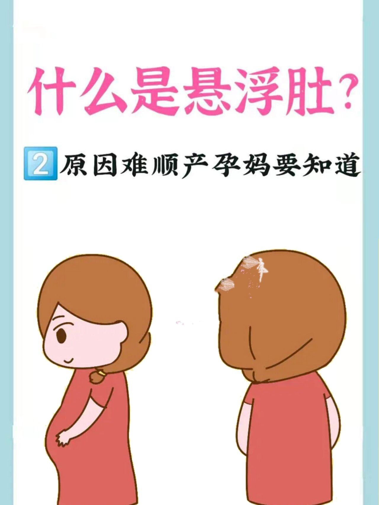 什么是悬浮肚?不能顺产吗?