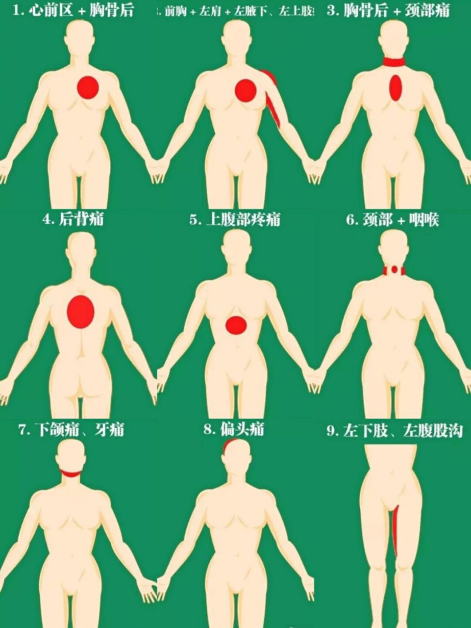 【重要】急性心梗10个常见疼痛部位及图解 当有急性心梗高危因素的