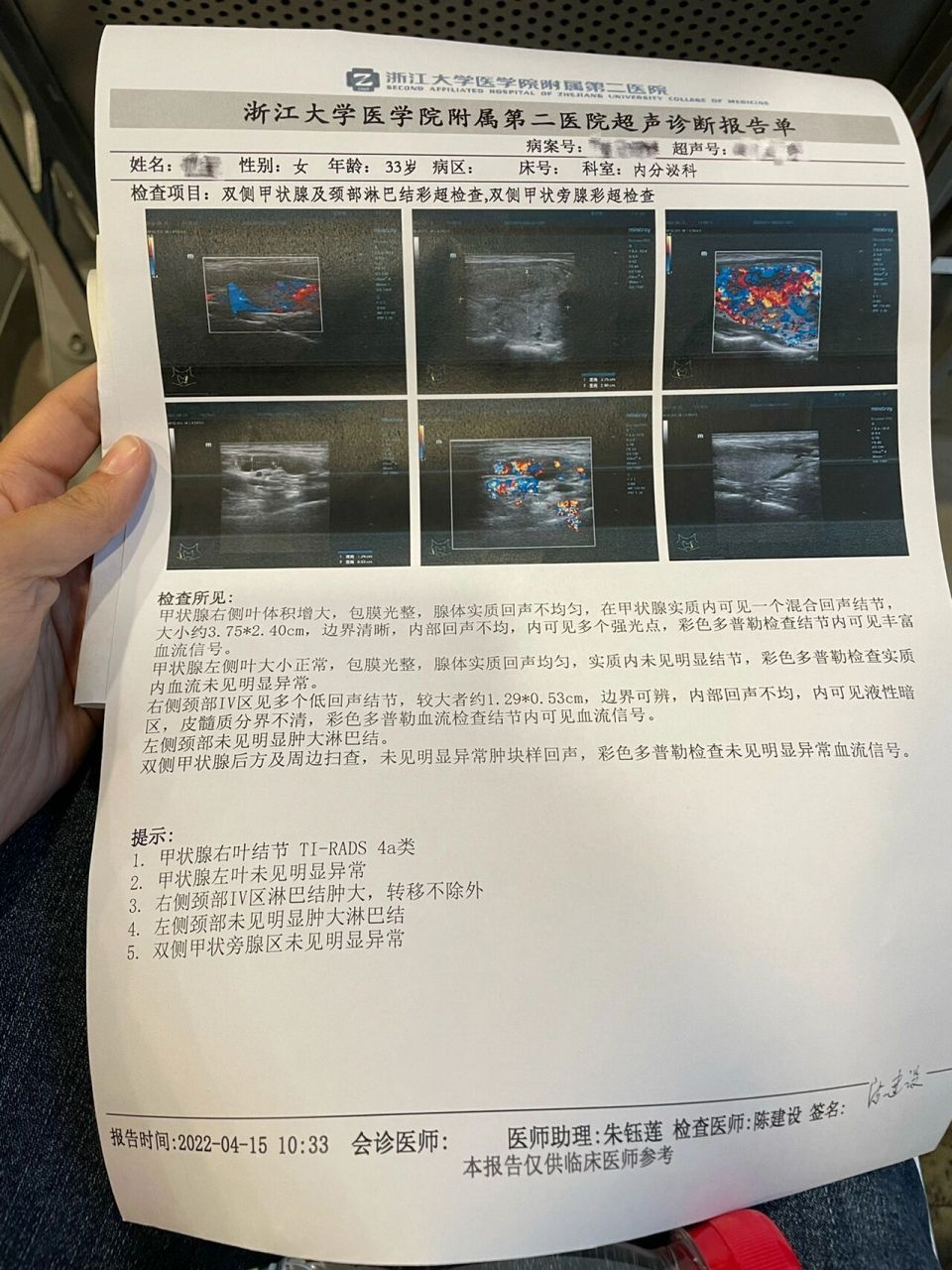 甲状腺乳头状癌检查篇 公司体检出右侧甲状腺结节4厘米,然后去浙二
