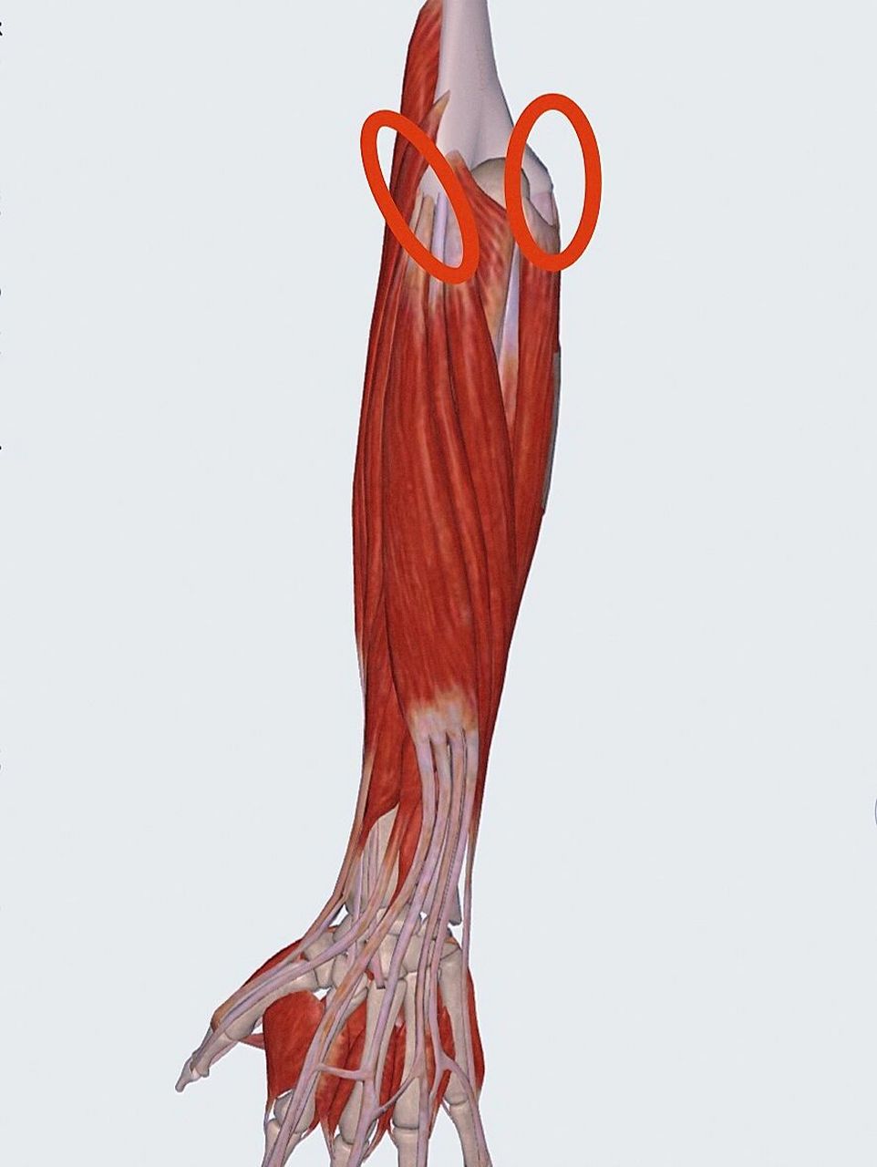 1:大多数人都是肱骨外上髁位置 小臂偏外侧位置牵扯疼痛,特别是在一些