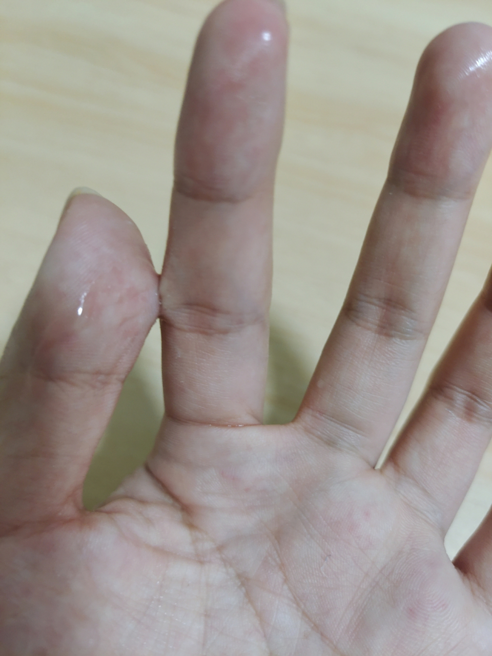 502粘手上,亲试有用的方法 这辈子,能不用502就不用了,第一次用,滴到