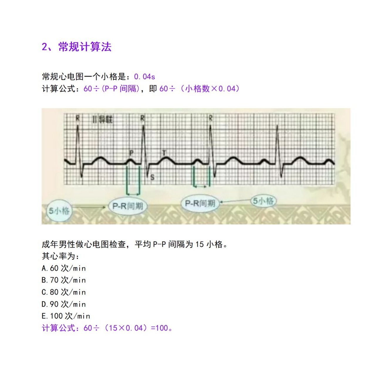 心电图怎么算心率图片